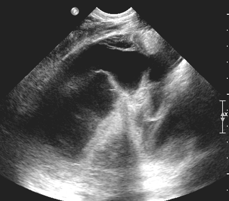 Image Gently and Ultrasound Medical Professionals